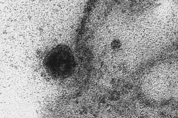 Virus Corona saat memasuki sel tubuh manusia.