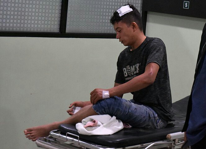 Salah seorang korban terluka akibat tawuran warga di Pekanbaru. Foto: Antarariau