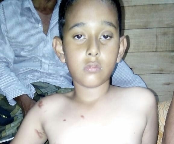 Nasri (11 tahun) korban selamat kapal karam di Perairan Rupat Utara.