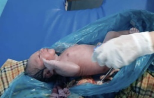 Sesosok bayi terbungkus  didalam plastik ditemukan dalam sebuah Becak. Bayi tersebut ditemukan dalam kondisi hidup dengan tali pusar masih melekat ditubuhnya