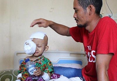 Putra Ramadhan penderita kanker mata.