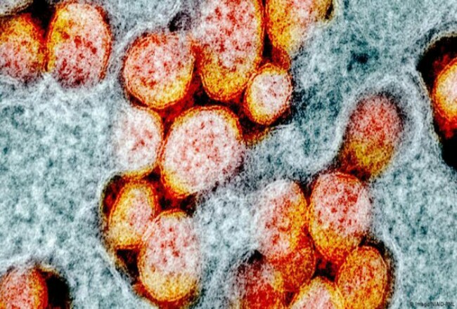 Ilustrasi mutasi virus Corona. Foto: Detik