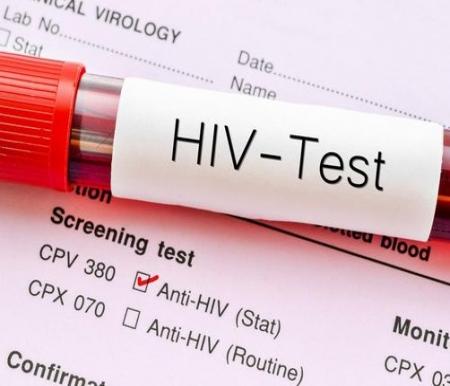 ilustrasi HIV Test