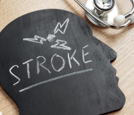 Ilustrasi stroke. (Foto: Getty Images/iStockphoto/designer491)